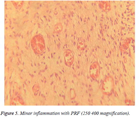 biomedres-Minor-inflammation