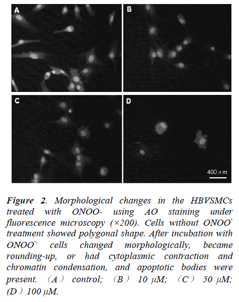 biomedres-Morphological-changes-HBVSMCs