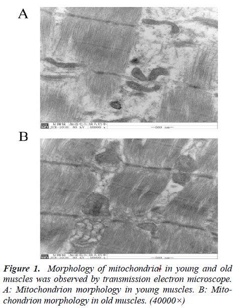 biomedres-Morphology-mitochondrial