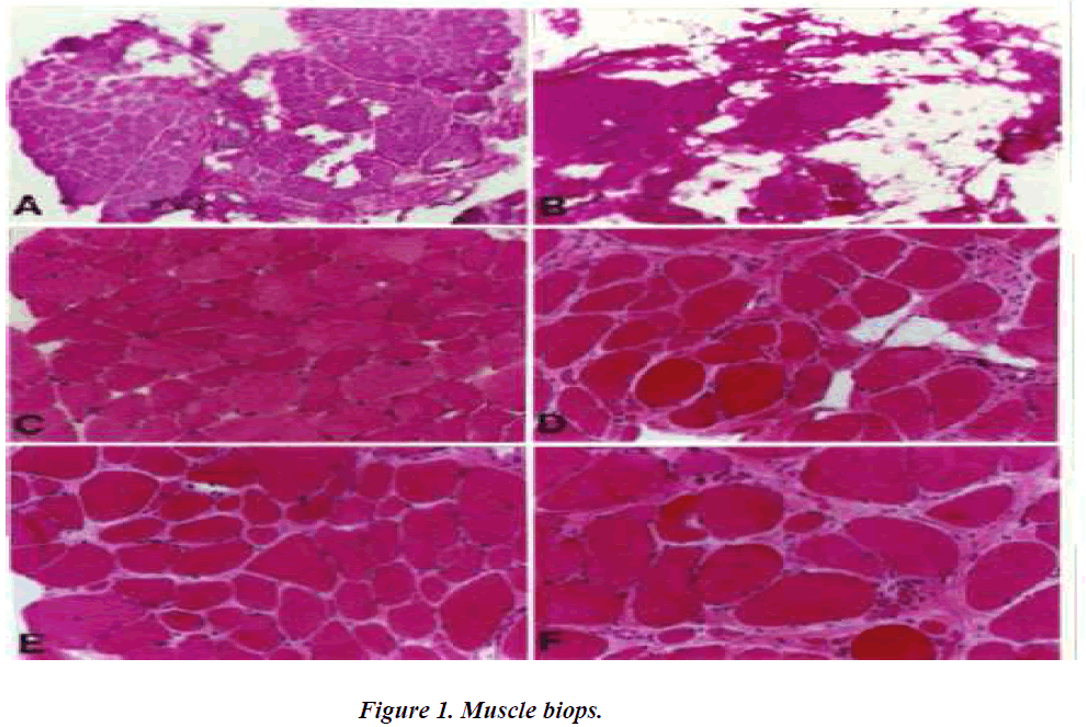 biomedres-Muscle-biops