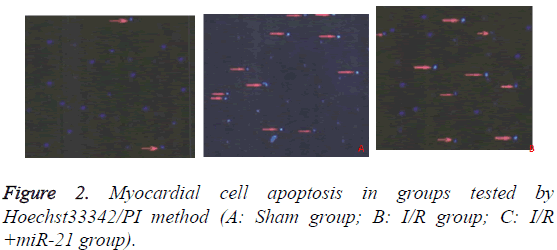 biomedres-Myocardial-cell-apoptosis