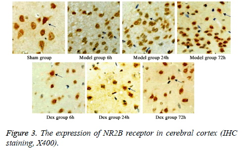 biomedres-NR2B-receptor