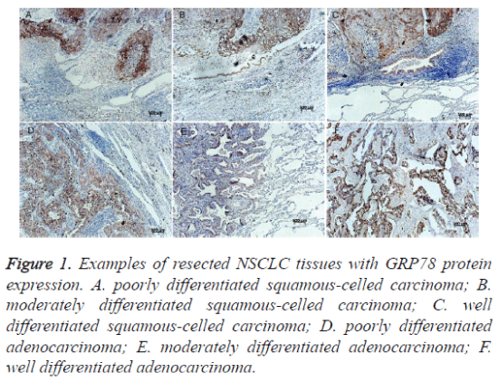 biomedres-NSCLC-tissues
