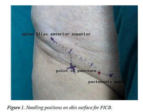 biomedres-Needling-positions