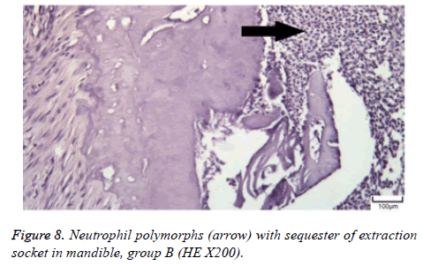 biomedres-Neutrophil-arrow