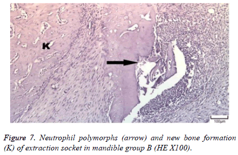 biomedres-Neutrophil-polymorphs