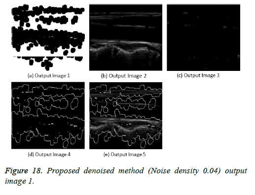 biomedres-Noise-density