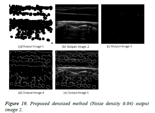 biomedres-Noise-density