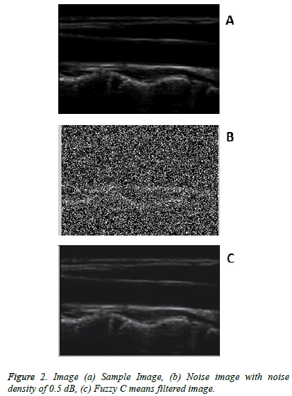 biomedres-Noise-image-density-Fuzzy-means-filtered