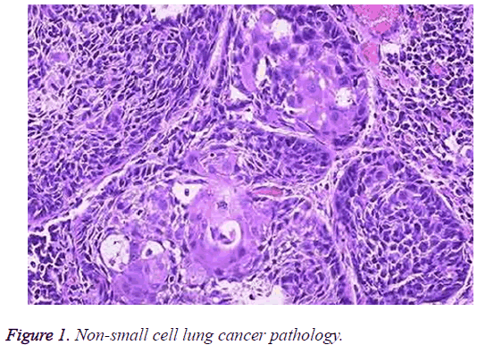 biomedres-Non-small-cell