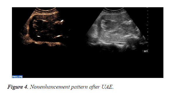 biomedres-Nonenhancement