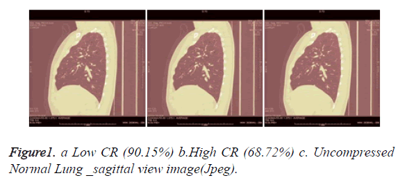 biomedres-Normal-Lung