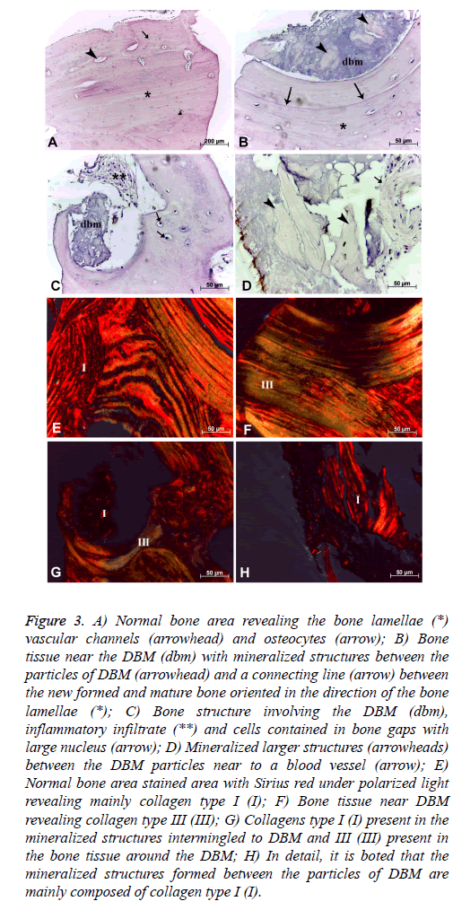 biomedres-Normal-bone