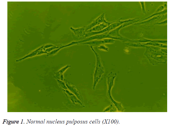 biomedres-Normal-nucleus-pulposus