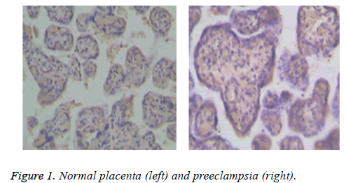 biomedres-Normal-placenta