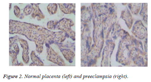 biomedres-Normal-placenta