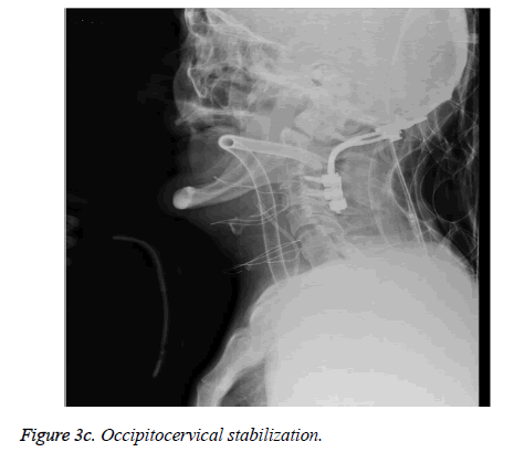 biomedres-Occipitocervical