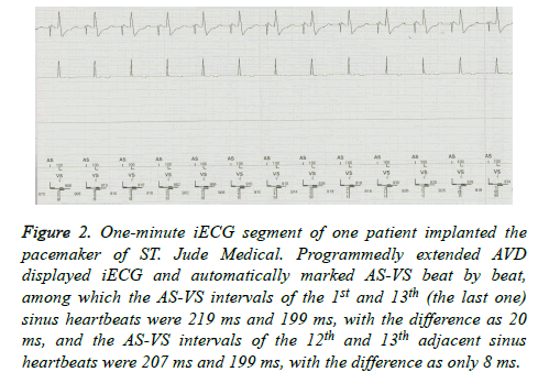 biomedres-One-minute-iECG