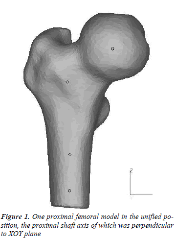 biomedres-One-proximal-femoral