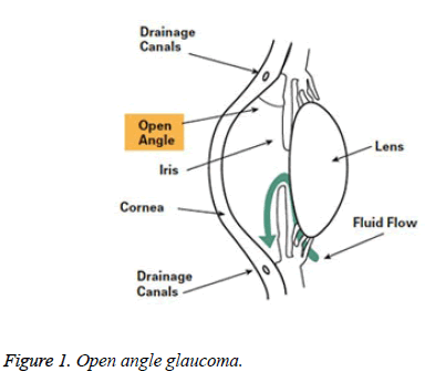 biomedres-Open-angle