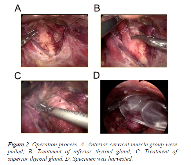 biomedres-Operation-process