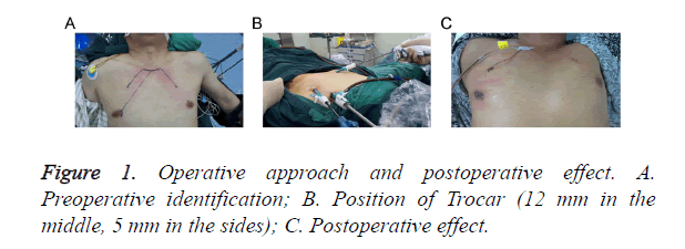 biomedres-Operative-approach