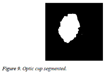 biomedres-Optic-cup