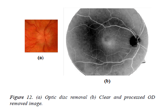 biomedres-Optic-disc