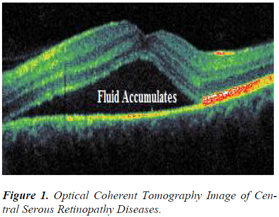 biomedres-Optical-Coherent