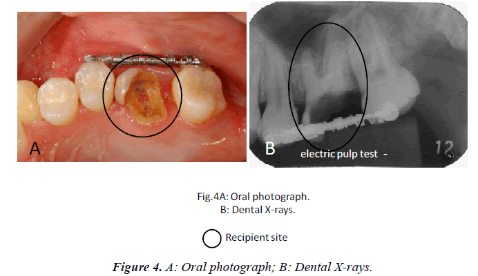 biomedres-Oral-photograph-Dental