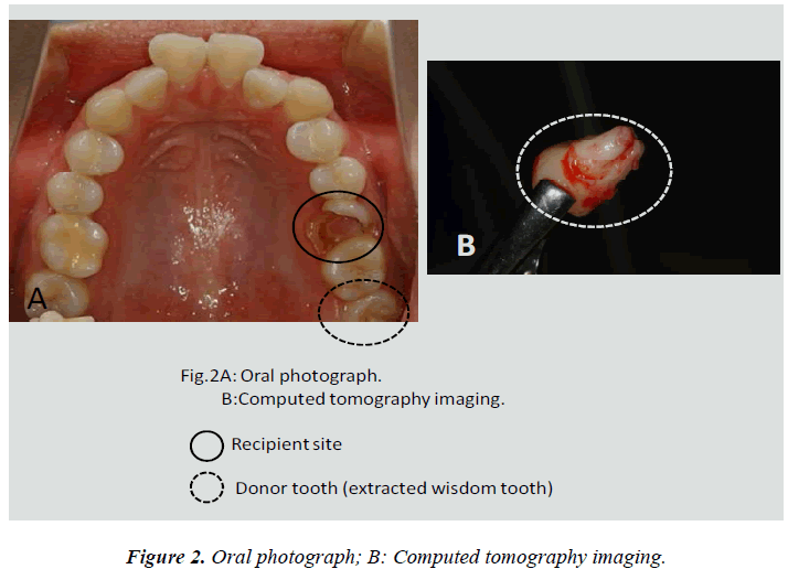 biomedres-Oral-photograph-tomography-23-3-438-g002