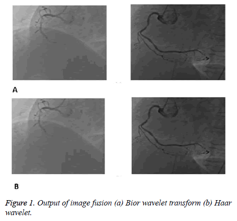 biomedres-Output-image