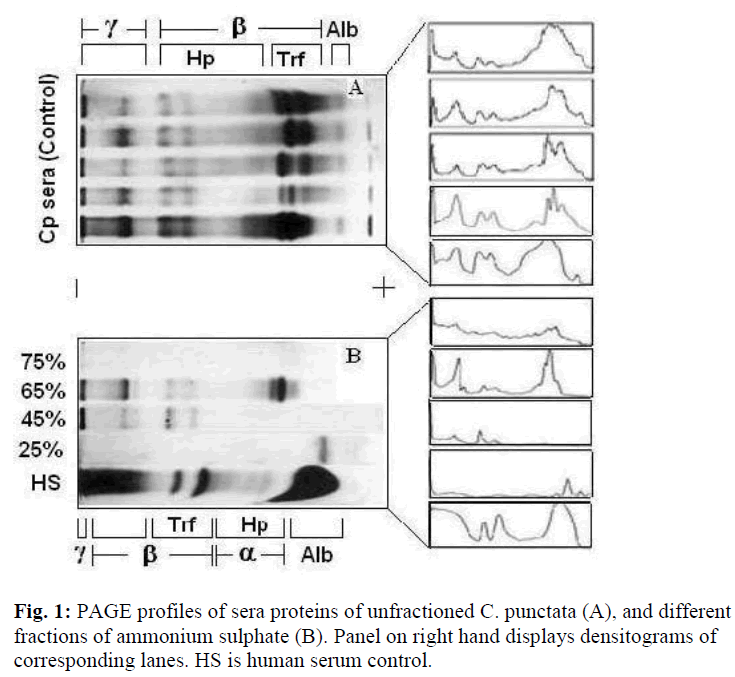 biomedres-PAGE-profiles-sera-proteins