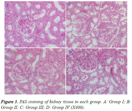 biomedres-PAS-staining-kidney