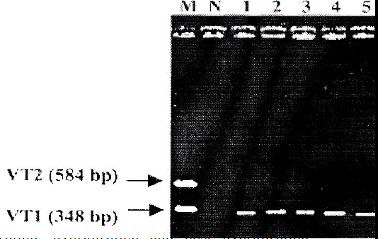 biomedres-PCR-results-obtained-EPEC-isolates