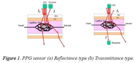 biomedres-PPG-sensor-Reflectance-Transmittance