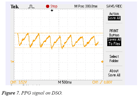 biomedres-PPG-signal-DSO