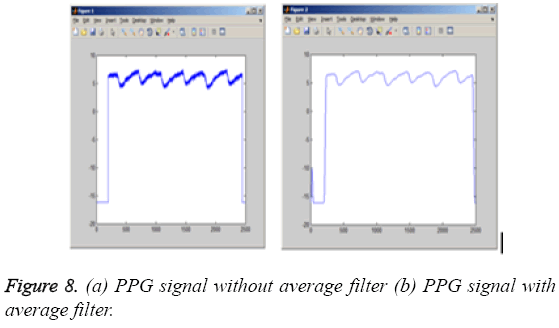 biomedres-PPG-signal-average-filter