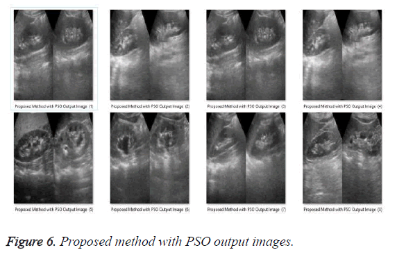 biomedres-PSO-output