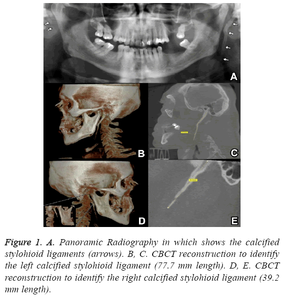 biomedres-Panoramic-Radiography-calcified