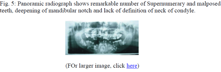 biomedres-Panoramic-radiograph