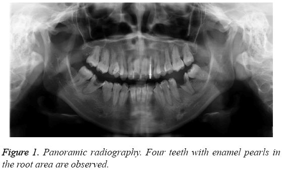 biomedres-Panoramic-radiography