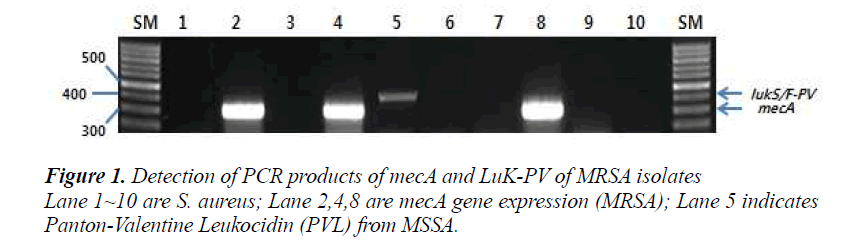 biomedres-Panton-Valentine-Leukocidin