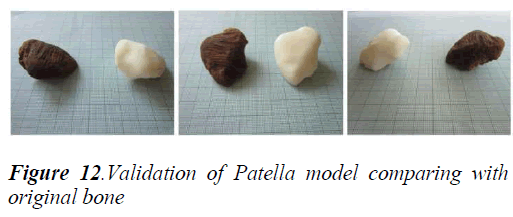 biomedres-Patella-model-comparing