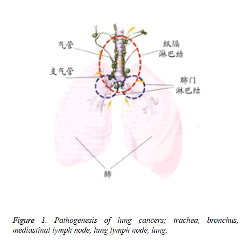 biomedres-Pathogenesis-lung