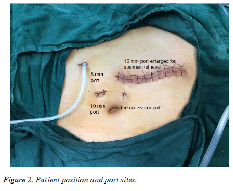 biomedres-Patient-position