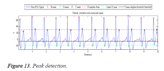 biomedres-Peak-detection