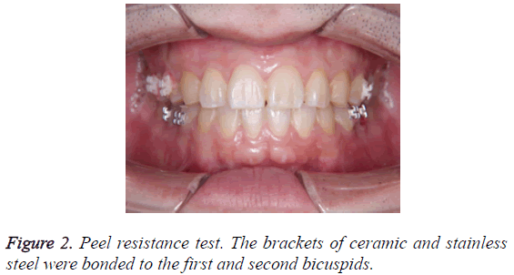 biomedres-Peel-resistance-test