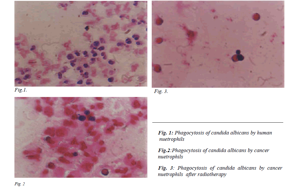 biomedres-Phagocytosis-candida-albicans