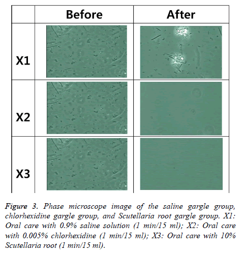 biomedres-Phase-microscope